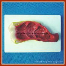 Human Rectum Inner Cavity Model with Plastic Base